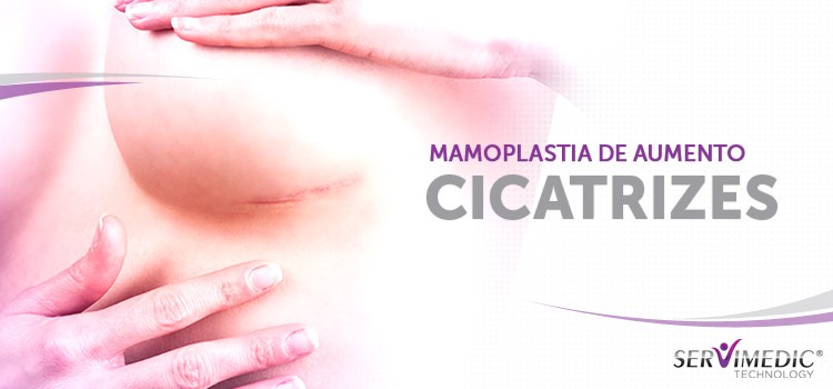 Mamoplastia de Aumento - Cicatrizes